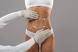 Comprehensive Guide to Body Contouring with Dr. Foti Sofiadellis